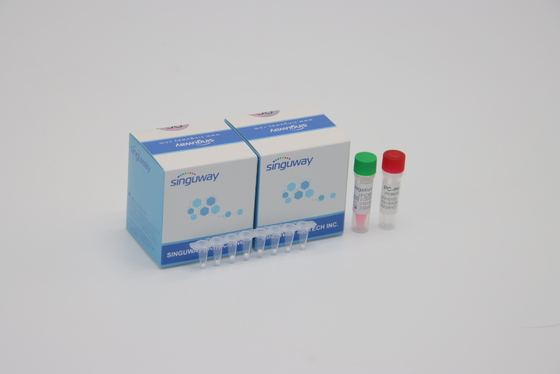 Hiv-Virus quantitatives Leuchtstoff Realzeit CER der PCR-Entdeckungs-Ausrüstungs-POCT