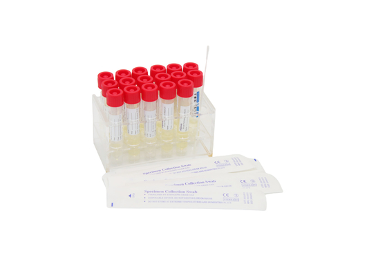 Nasenrachenraumzellputzlappen-Wegwerfvirus, das Kit Specimen Collection Tube 3mL probiert