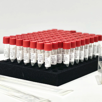 Rohr der Pharynx-nasales Putzlappen-Beispielfreigabe-Reagens-Extraktions-Ausrüstungs-0.5mL/ohne Aufbereitung