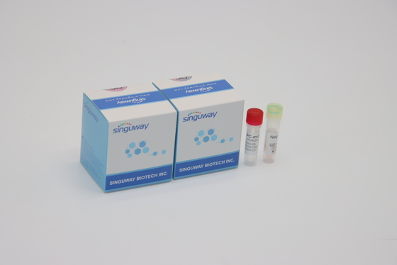 Quantitative Leuchtstoffpcr-Entdeckungs-Ausrüstung IVD für alle Corona Virus Mutations