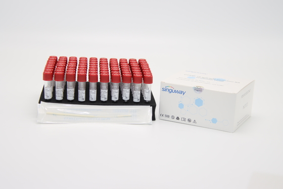 CER Virenrohr der nukleinsäure-Isolierungs-Kit Viral-RNS-DNA-Extraktions-Ausrüstungs-1mL/