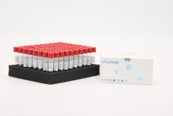 Singuway PCR-Test-Grippe-Virus-Beispielfreigabe-Reagens RNS Extraktions-Ausrüstung