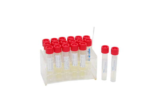 Wegwerfvirus 2mL, das Reagenzglas Kit Medicals VTM mit Rachenabstrich-Stock probiert