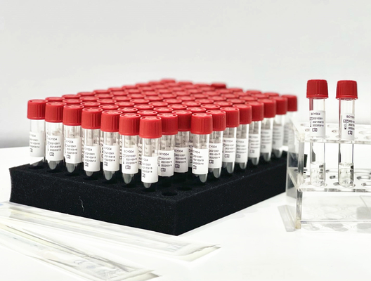 Eine Schritt-Beispielfreigabe-Reagens PCR-Extraktion Kit From Patient Pharynx Swab